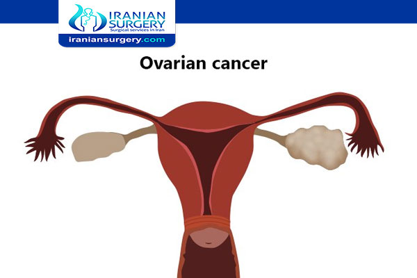 Ovarian Cancer Risk Factors