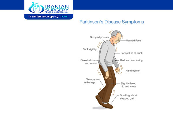 Parkinson's disease has symptoms