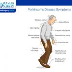 Parkinson's disease stages
