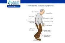 Stages of parkinson's disease | End-stage parkinson's disease