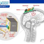 Parkinson’s disease treatment