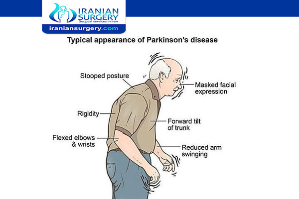 هل مرض باركنسون خطير؟