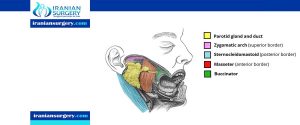 Parotid gland surgery in Iran