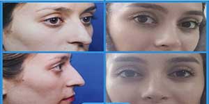 Plastic surgery