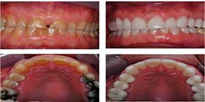 Pic-2