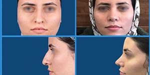 Plastic surgery