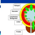 Rectal Cancer Staging