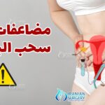 الاستحمام بعد عملية سحب البويضات