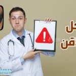 مشاكل زراعة الذقن