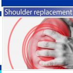 Shoulder Replacement Surgery Success Rate