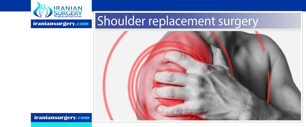 Shoulder Replacement Surgery Success Rate