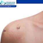 Signs of Infection after Laparoscopic Surgery
