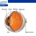 Small incision lenticule extraction