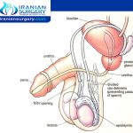 استخراج الحيوانات المنويه من الخصيه