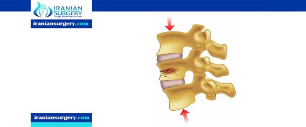 back pain compression fracture treatment
