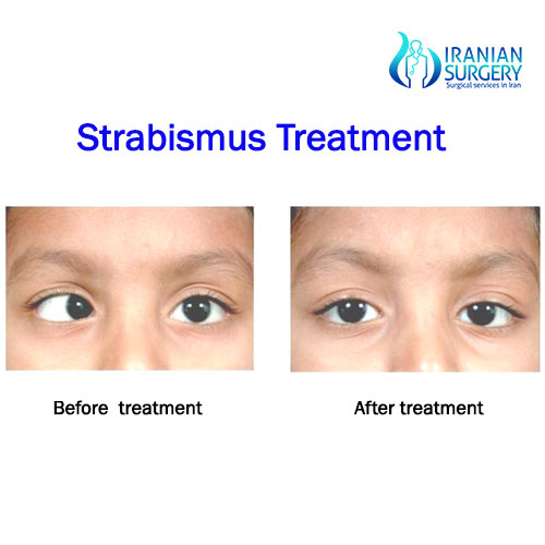 Adult strabismus surgeons
