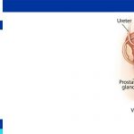 Testicular Cancer Test