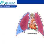 وجود ماء في الرئة بعد عملية القلب المفتوح
