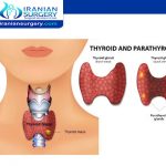 Thyroid cancer treatment