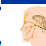 Trigeminal Neuralgia Treatment