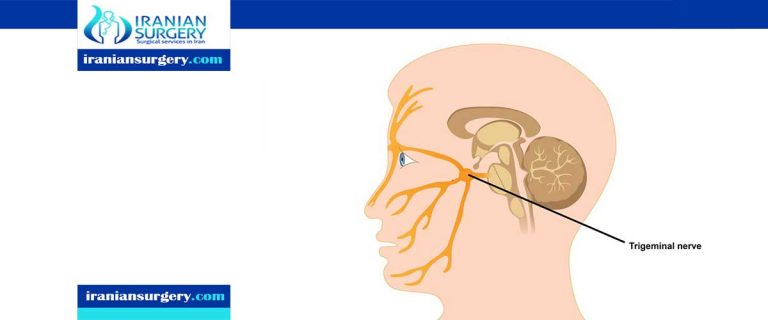 Trigeminal neuralgia | Treatment for trigeminal neuralgia | Iranian Surgery