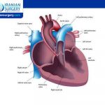 Types Of Heart Surgery