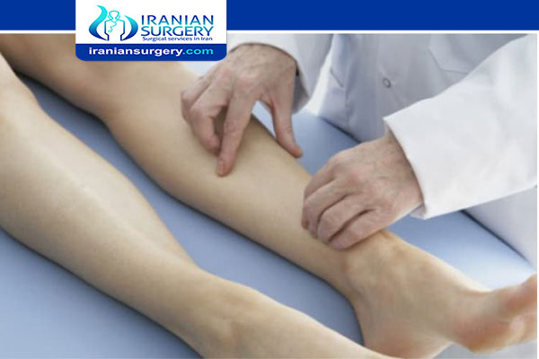 Varicose vein laser surgery recovery time