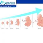 What happens when two embryos are transferred