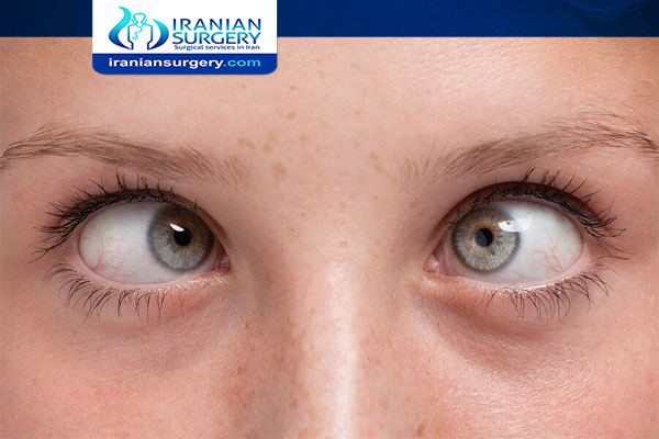 انحراف العين علاج انحراف العين أعراض انحراف العين درجات انحراف البصر