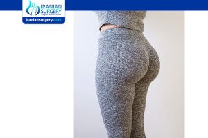 liposuction in Iran