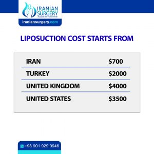 liposuction in iran 2022