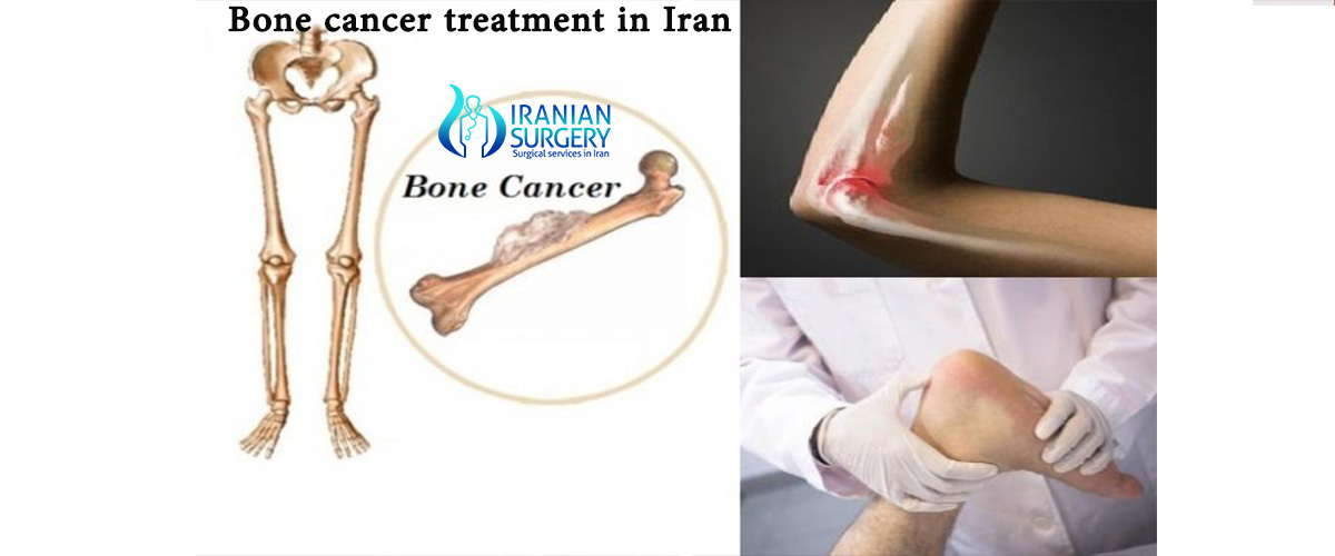 Bone cancer treatment in Iran