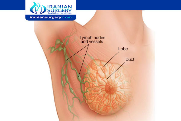 اعراض العلاج الإشعاعي لسرطان الثدي