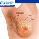 اعراض العلاج الکیماوي لسرطان الثدي