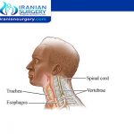 cervical fracture symptoms