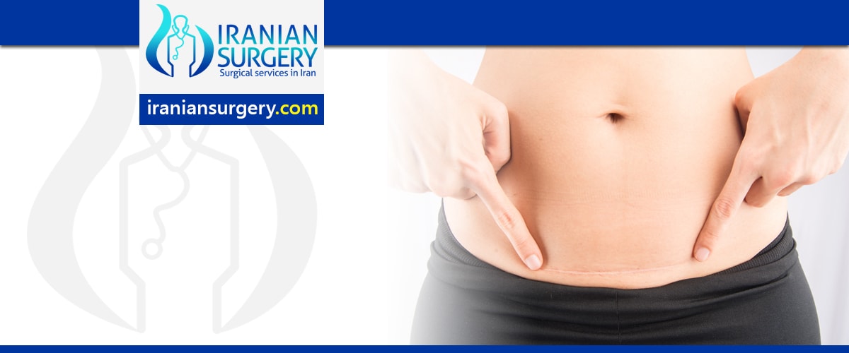Cesarean section recovery