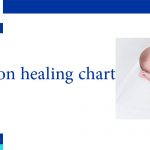circumcision healing chart