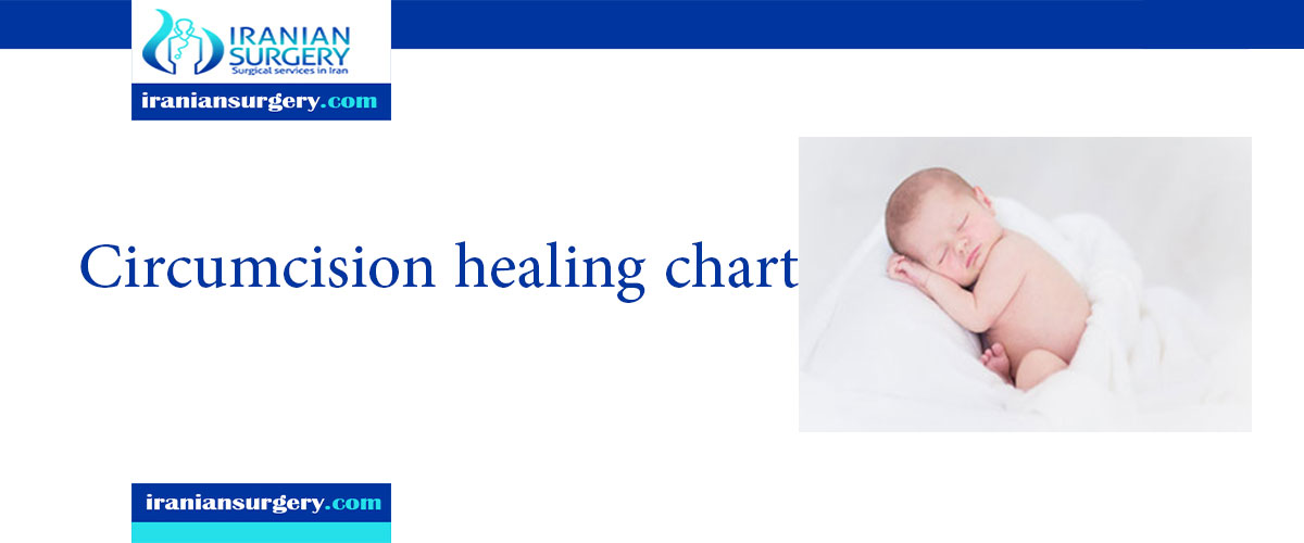 circumcision healing chart