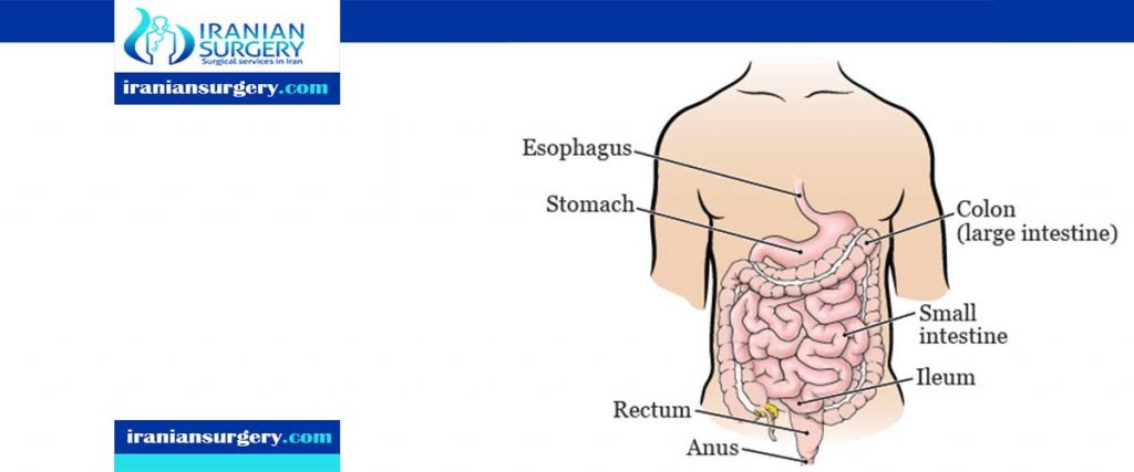 colectomy surgery complications