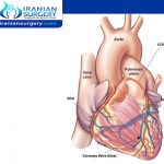 مرض الشريان التاجي