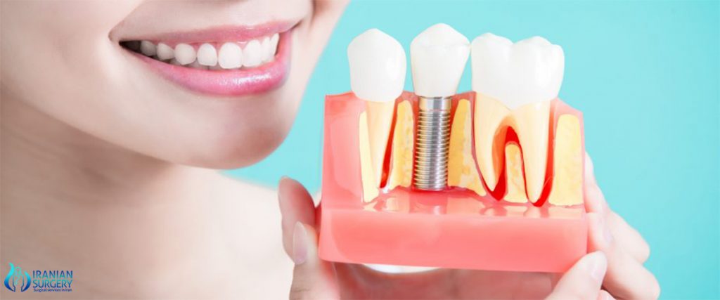 cost of full dental implant iran