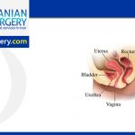 cystocele and rectocele at the same time