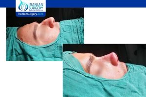 dr mosleh surgeries preview3