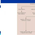 ectopic pregnancy approach