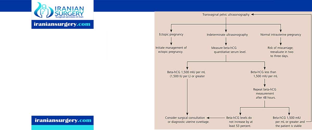 ectopic pregnancy approach