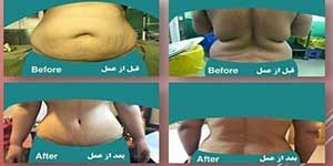 plastic surgery