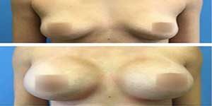 plastic surgery