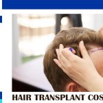 HAIR TRANSPLANT COST PER GRAFT