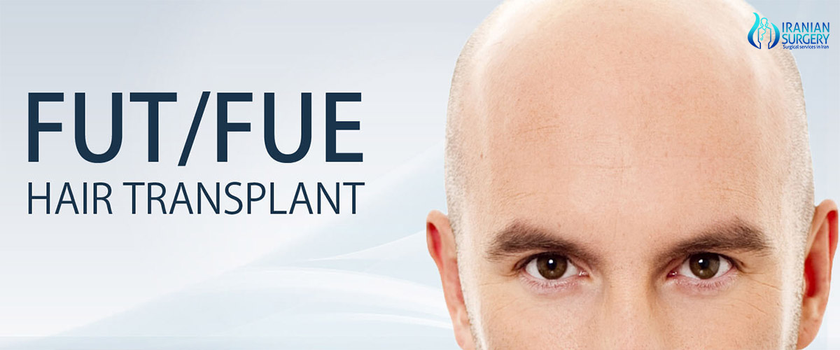 hair transplant in iran