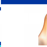 herniated disc surgery success rate